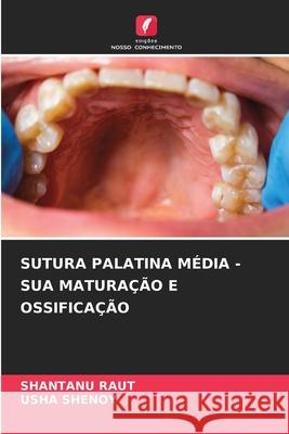 SUTURA PALATINA MÉDIA - SUA MATURAÇÃO E OSSIFICAÇÃO RAUT, SHANTANU, Shenoy, Usha 9786202334570