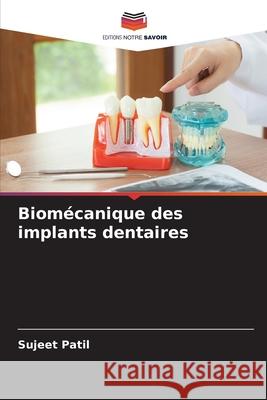 Biomécanique des implants dentaires Patil, Sujeet 9786202367363