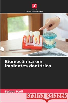 Biomecânica em implantes dentários Patil, Sujeet 9786202367394