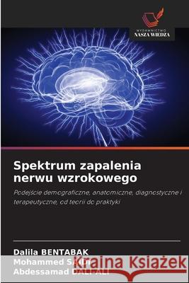 Spektrum zapalenia nerwu wzrokowego BENTABAK, Dalila, SAÏDI, Mohammed, DALI-ALI, Abdessamad 9786202376365
