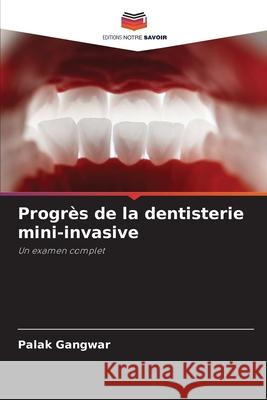 Progrès de la dentisterie mini-invasive Gangwar, Palak 9786202376495 Editions Notre Savoir
