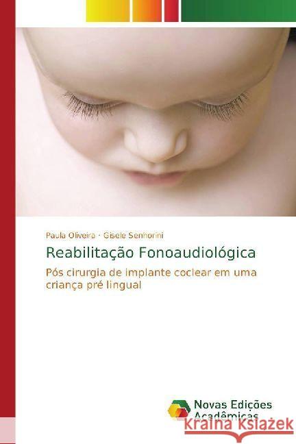 Reabilitação Fonoaudiológica : Pós cirurgia de implante coclear em uma criança pré lingual Oliveira, Paula; Senhorini, Gisele 9786202403085