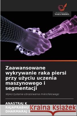 Zaawansowane wykrywanie raka piersi przy uzyciu uczenia maszynowego i segmentacji K, ANASTRAJ, A, RAJAPRABHU, S, DHARMARAJ 9786202418737 Wydawnictwo Nasza Wiedza