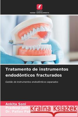 Tratamento de instrumentos endodônticos fracturados Soni, Ankita, Jain, Pradeep, Patni, Dr. Pallav 9786202423458