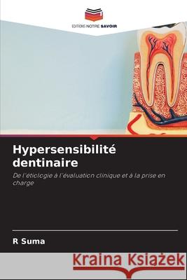 Hypersensibilité dentinaire Suma, R 9786202424806