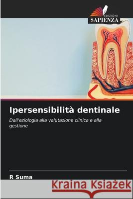 Ipersensibilità dentinale Suma, R 9786202424813