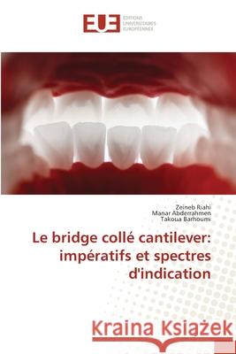 Le bridge collé cantilever: impératifs et spectres d'indication Riahi, Zeineb, Abderrahmen, Manar, Barhoumi, Takoua 9786202426763 Éditions universitaires européennes