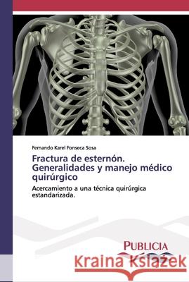 Fractura de esternón. Generalidades y manejo médico quirúrgico Fernando Karel Fonseca Sosa 9786202431606