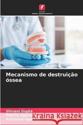 Mecanismo de destruição óssea Gupta, Shivani, Agarwal, Prerna, Agarwal, Ashutosh 9786202452977