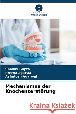 Mechanismus der Knochenzerstörung Gupta, Shivani, Agarwal, Prerna, Agarwal, Ashutosh 9786202452984