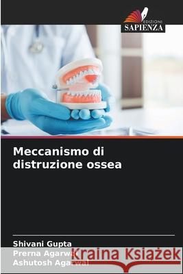 Meccanismo di distruzione ossea Gupta, Shivani, Agarwal, Prerna, Agarwal, Ashutosh 9786202453011