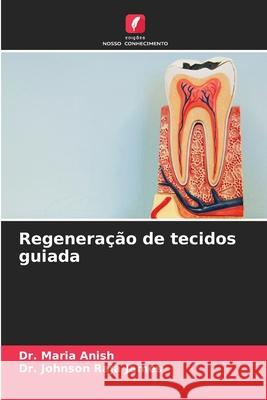 Regeneração de tecidos guiada Anish, Dr. Maria, James, Dr. Johnson Raja 9786202456975