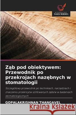 Zab pod obiektywem: Przewodnik po przekrojach nazebnych w stomatologii THANGAVEL, GOPALAKRISHNAN 9786202471480