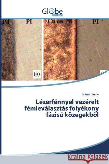 Lézerfénnyel vezérelt fémleválasztás folyékony fázisú közegekböl László, Nánai 9786202486057