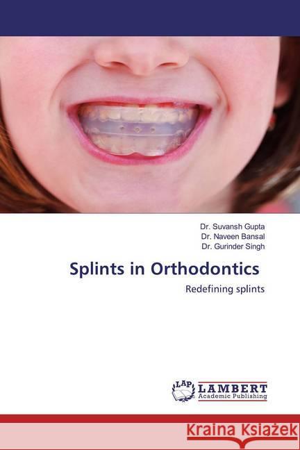 Splints in Orthodontics : Redefining splints Gupta, Dr. Suvansh; Bansal, Dr. Naveen; Singh, Dr. Gurinder 9786202514330