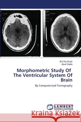 Morphometric Study Of The Ventricular System Of Brain Brij Raj Singh, Ujwal Gajbe 9786202518109 LAP Lambert Academic Publishing