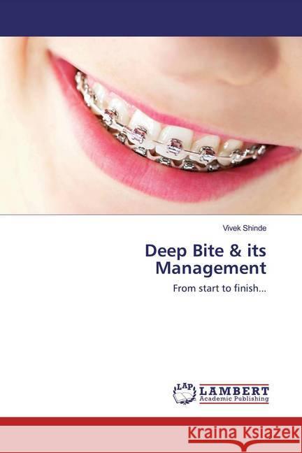 Deep Bite & its Management : From start to finish... Shinde, Vivek 9786202519533 LAP Lambert Academic Publishing