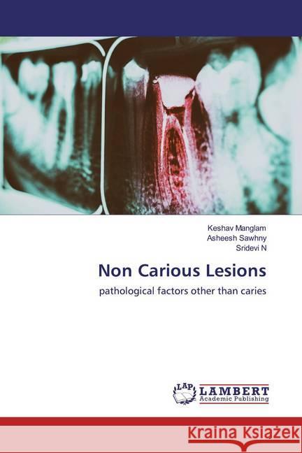 Non Carious Lesions : pathological factors other than caries Manglam, Keshav; Sawhny, Asheesh; N, Sridevi 9786202521512