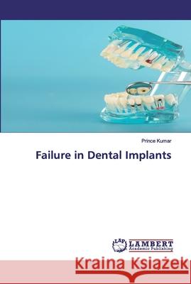 Failure in Dental Implants Kumar, Prince 9786202526593
