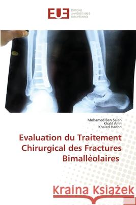 Evaluation du Traitement Chirurgical des Fractures Bimalléolaires Ben Salah, Mohamed 9786202534819 Editions Universitaires Europeennes