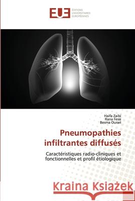 Pneumopathies infiltrantes diffusés Zaibi, Haifa 9786202538541