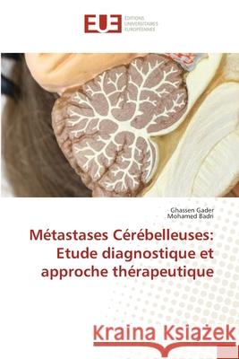 Métastases Cérébelleuses: Etude diagnostique et approche thérapeutique Gader, Ghassen 9786202547703 Editions Universitaires Europeennes