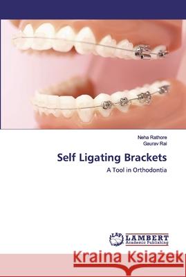 Self Ligating Brackets Neha Rathore, Gaurav Rai 9786202552042 LAP Lambert Academic Publishing