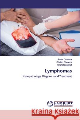 Lymphomas Chaware, Smita 9786202555456 LAP Lambert Academic Publishing