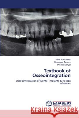 Textbook of Osseointegration Kumthekar, Minal 9786202563208 LAP Lambert Academic Publishing