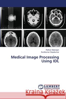 Medical Image Processing Using IDL Rathan Natarajan, Sunilkumar Gopakumar 9786202565998