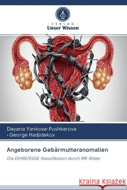 Angeborene Gebärmutteranomalien : Die ESHRE/ESGE-Klassifikation durch MR-Bilder Yankova-Pushkarova, Dayana; Hadjidekov, George 9786202582728 Sciencia Scripts