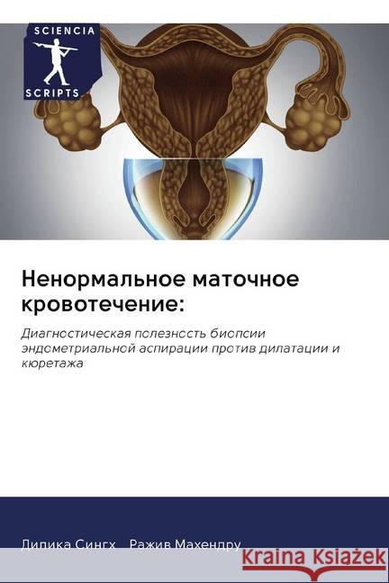 Nenormal'noe matochnoe krowotechenie: : Diagnosticheskaq poleznost' biopsii ändometrial'noj aspiracii protiw dilatacii i küretazha Singh, Dipika; Mahendru, Razhiw 9786202588683