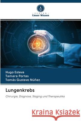 Lungenkrebs Hugo Esteva, Tamara Portas, Tomás Gustavo Núñez 9786202610810 Verlag Unser Wissen