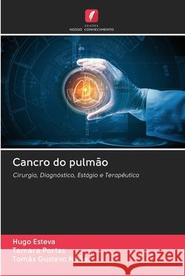 Cancro do pulmão Hugo Esteva, Tamara Portas, Tomás Gustavo Núñez 9786202610834 Edicoes Nosso Conhecimento