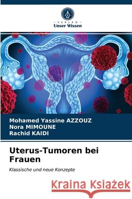 Uterus-Tumoren bei Frauen Mohamed Yassine Azzouz, Nora Mimoune, Rachid Kaidi 9786202648578 Verlag Unser Wissen