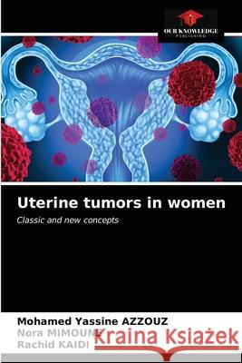 Uterine tumors in women Mohamed Yassine Azzouz Nora Mimoune Rachid Kaidi 9786202648585 Our Knowledge Publishing