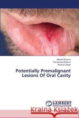 Potentially Premalignant Lesions Of Oral Cavity Akshat Sharma, Tanushree Sharma, Roshan Singh 9786202669245