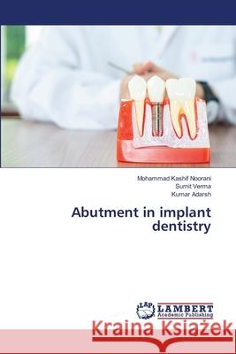 Abutment in implant dentistry Mohammad Kashif Noorani Sumit Verma Kumar Adarsh 9786202673259 LAP Lambert Academic Publishing