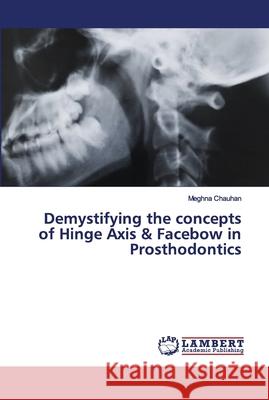 Demystifying the concepts of Hinge Axis & Facebow in Prosthodontics Meghna Chauhan 9786202673518