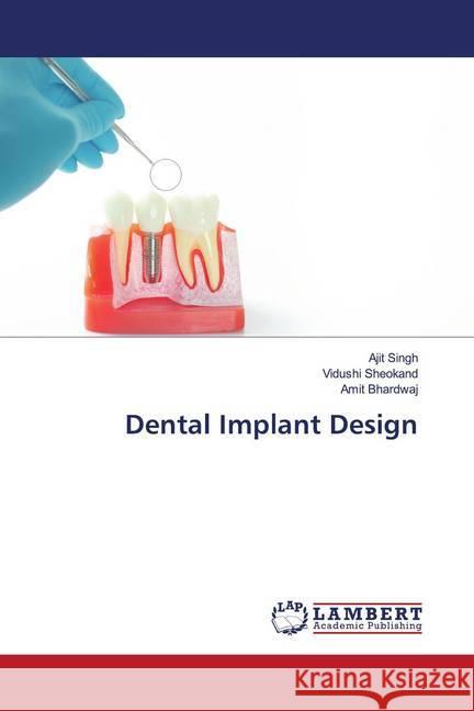 Dental Implant Design Singh, Ajit; Sheokand, Vidushi; Bhardwaj, Amit 9786202677011 LAP Lambert Academic Publishing