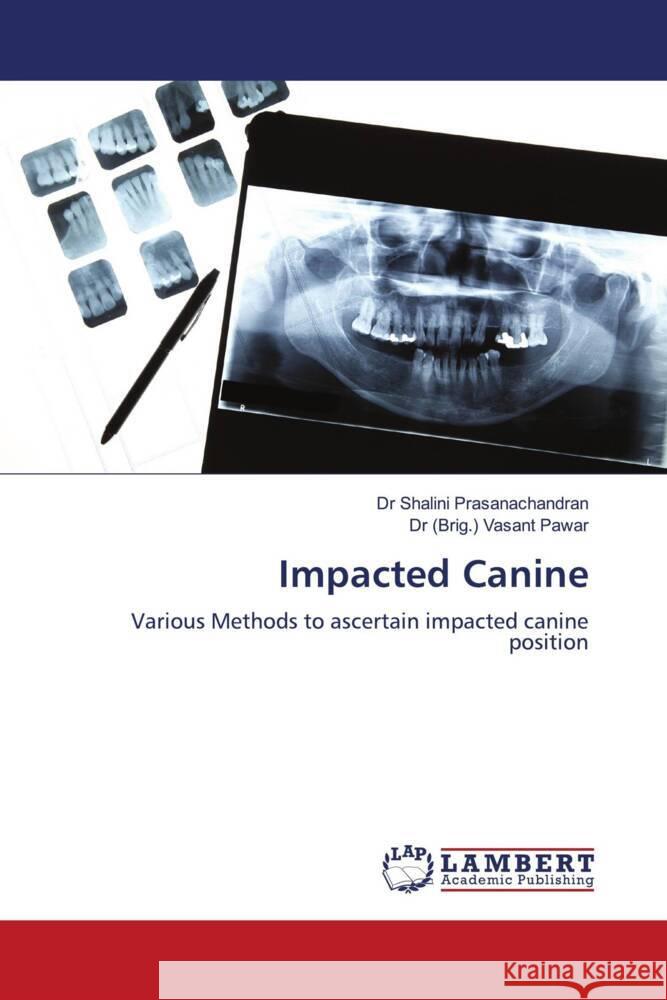 Impacted Canine Prasanachandran, Dr Shalini, Pawar, Dr (Brig.) Vasant 9786202679459 LAP Lambert Academic Publishing