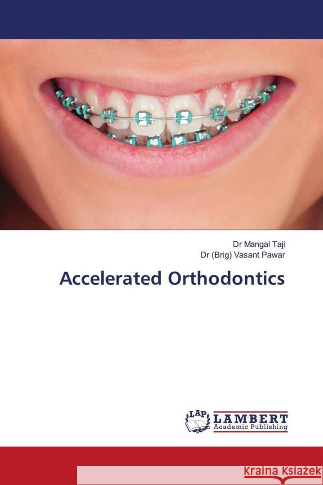 Accelerated Orthodontics Taji, Dr Mangal, Pawar, Dr (Brig) Vasant 9786202679756