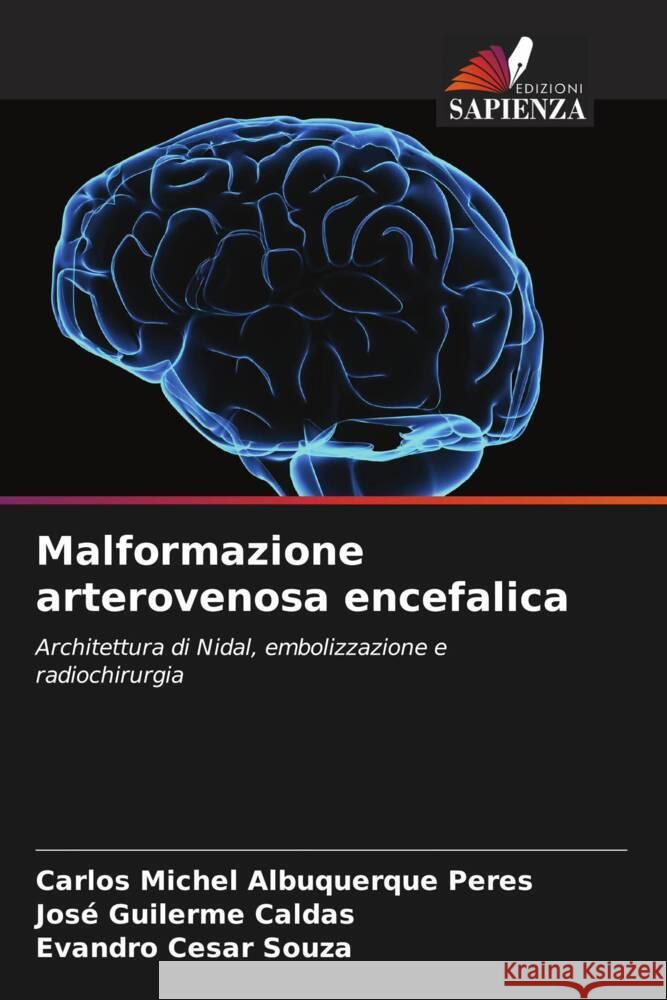 Malformazione arterovenosa encefalica Albuquerque Peres, Carlos Michel, Caldas, José Guilerme, Souza, Evandro Cesar 9786202737012