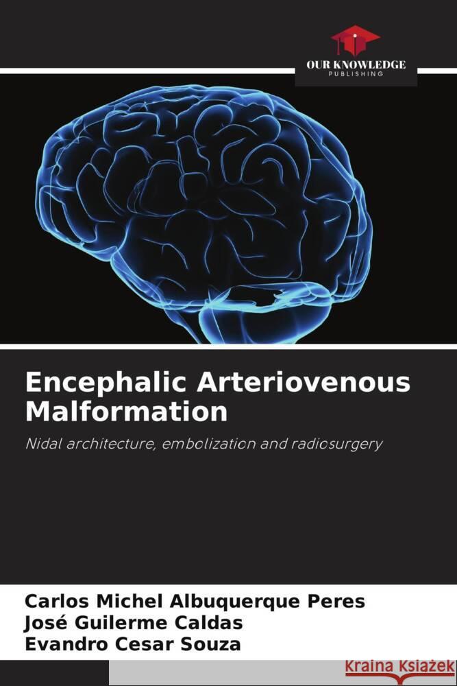 Encephalic Arteriovenous Malformation Albuquerque Peres, Carlos Michel, Caldas, José Guilerme, Souza, Evandro Cesar 9786202737531