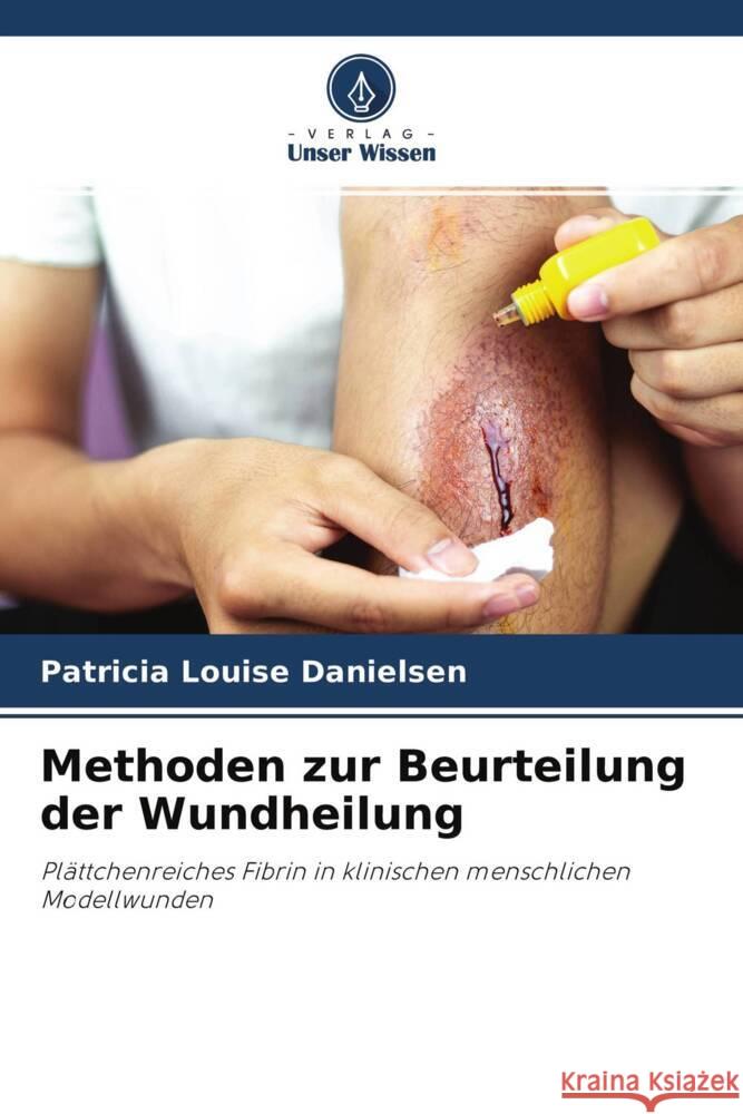 Methoden zur Beurteilung der Wundheilung Danielsen, Patricia Louise 9786202744560