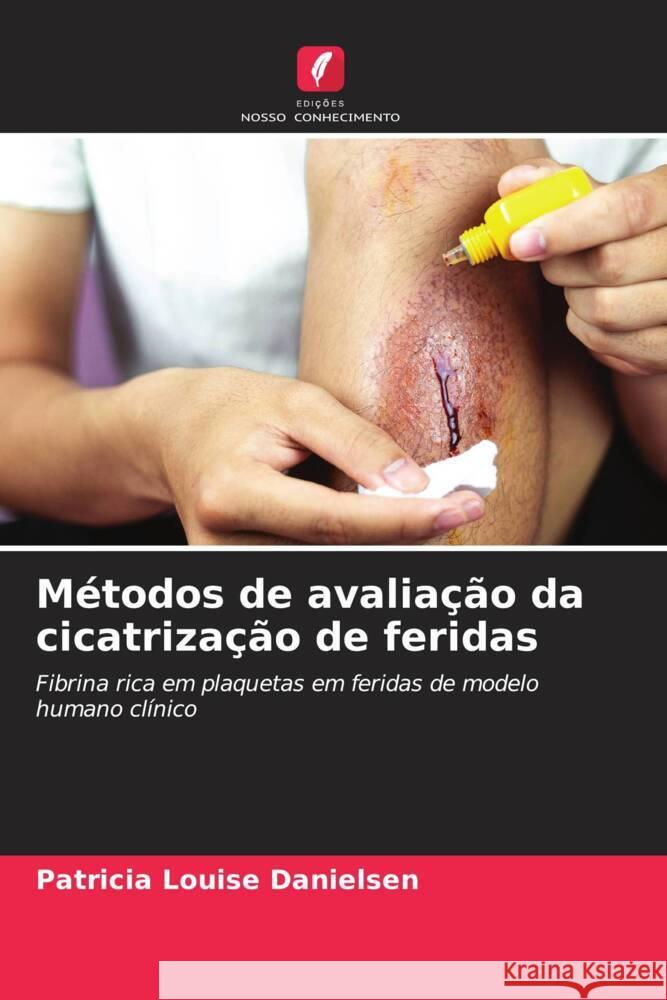 Métodos de avaliação da cicatrização de feridas Danielsen, Patricia Louise 9786202744591