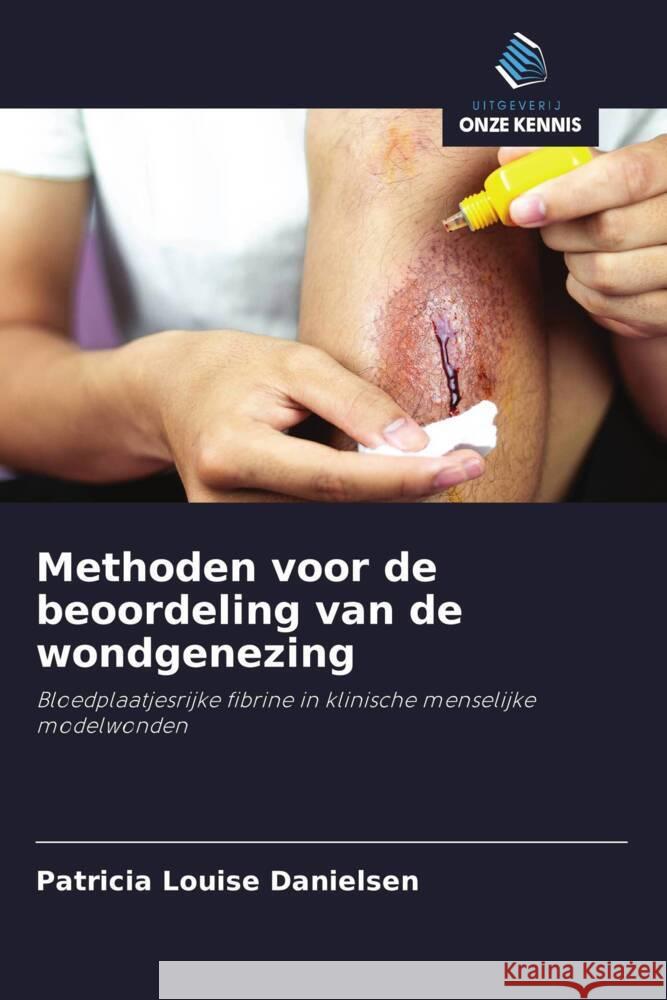 Methoden voor de beoordeling van de wondgenezing Danielsen, Patricia Louise 9786202744614