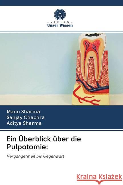 Ein Überblick über die Pulpotomie: Sharma, Manu; Chachra, Sanjay; Sharma, Aditya 9786202766449 Verlag Unser Wissen