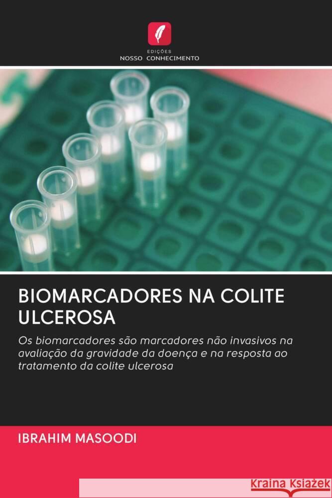 BIOMARCADORES NA COLITE ULCEROSA Masoodi, Ibrahim 9786202779470