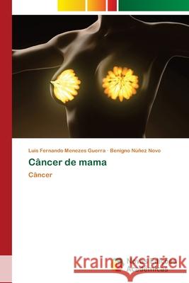 Câncer de mama Guerra, Luis Fernando Menezes 9786202807630